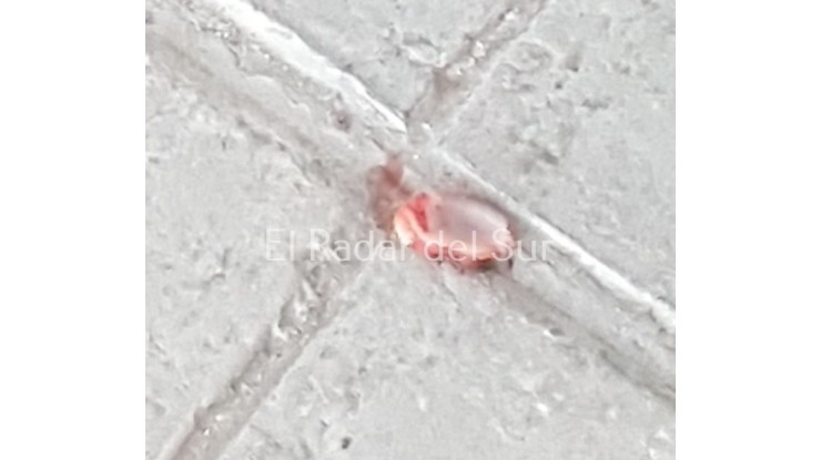 Le arrancó un pedazo de oreja de un mordiscón